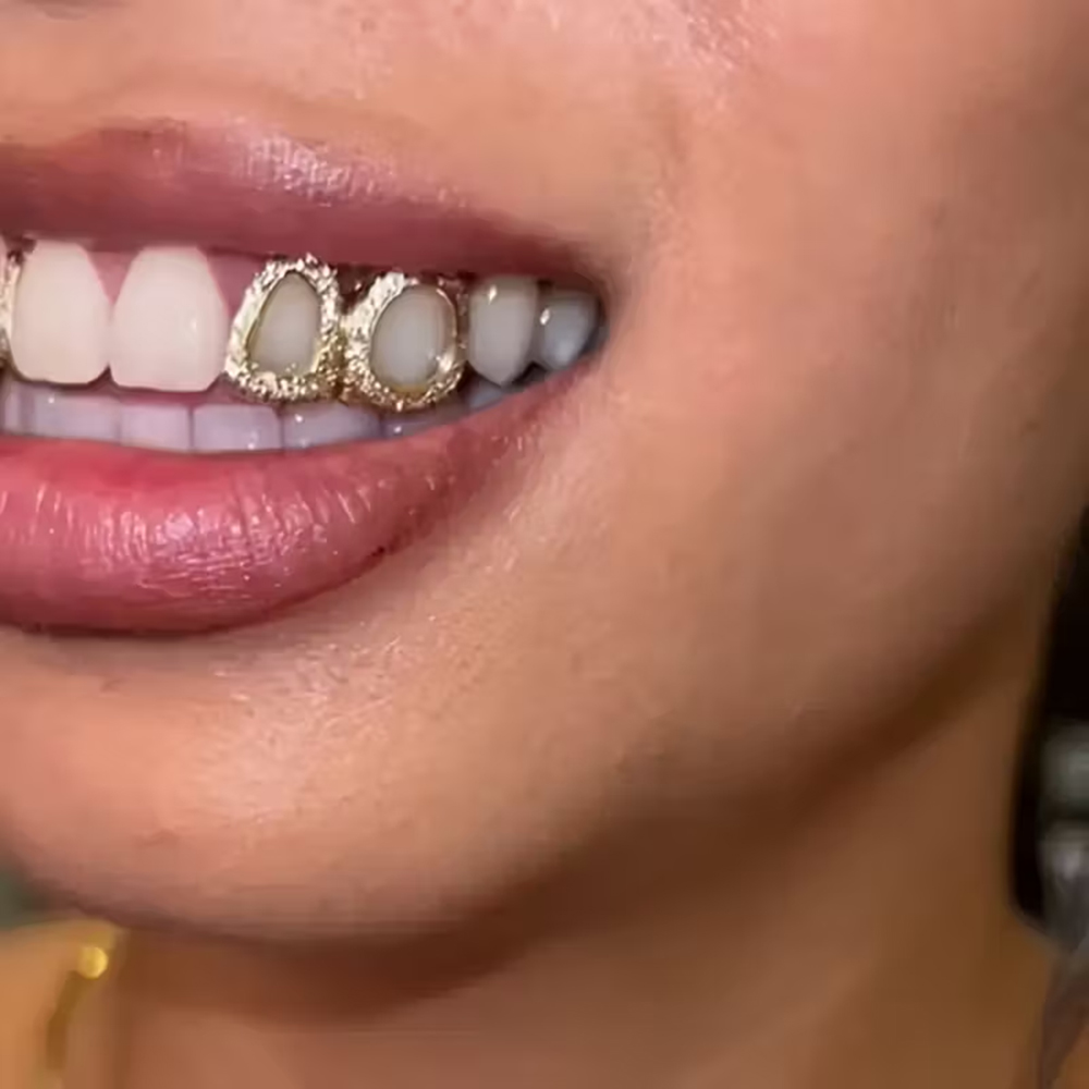 3 قطع إكسسوارات أسنان لامعة مج - مراجعة Street Fashion Jewelry وسعره